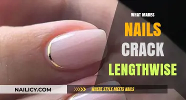 Why Nails Crack Lengthwise: Causes and Prevention Tips