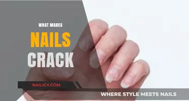 Why Nails Crack: Uncovering Causes and Prevention Tips