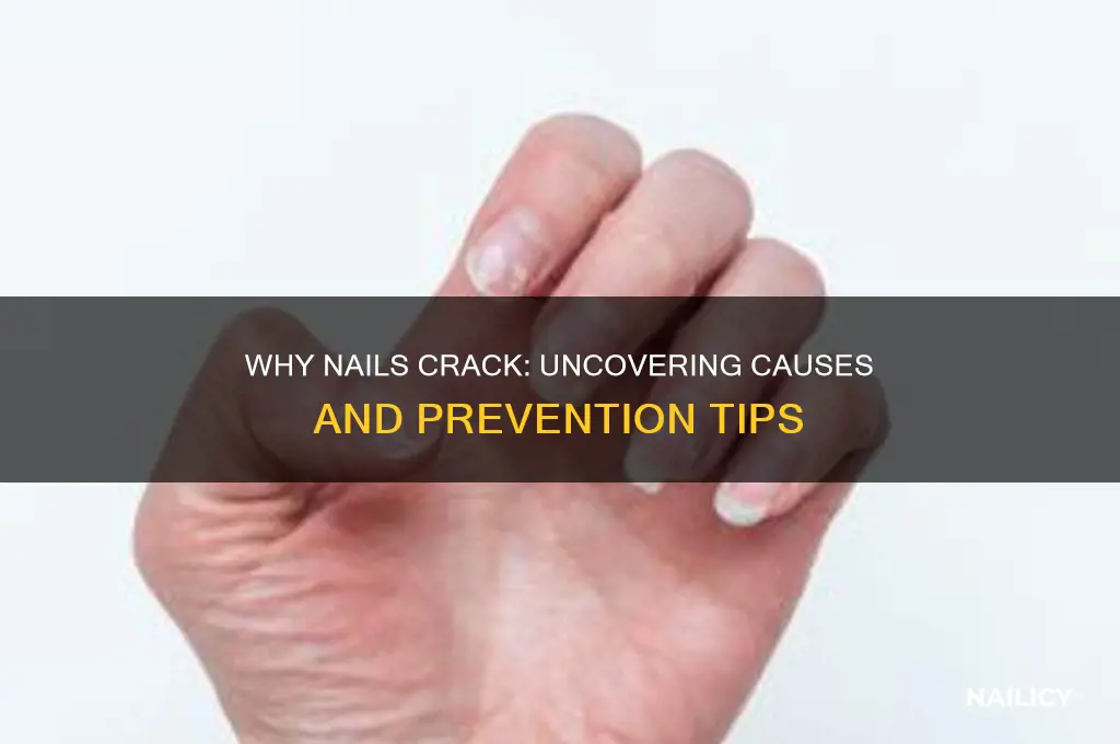what makes nails crack