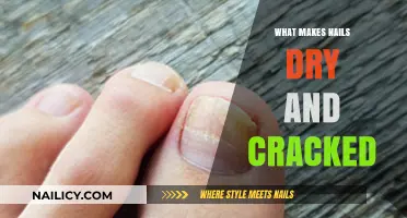 Understanding Dry, Cracked Nails: Causes, Prevention, and Effective Solutions