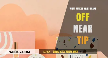 Why Do Nails Flake Near the Tip? Causes and Solutions