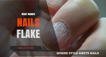 Why Do Nails Flake? Causes, Prevention, and Treatment Solutions