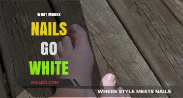 Why Nails Turn White: Causes, Prevention, and Treatment Explained