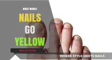Why Nails Turn Yellow: Causes, Prevention, and Treatment Solutions