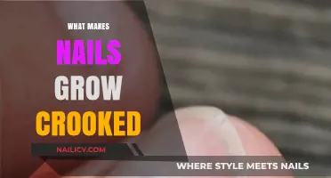 Why Nails Grow Crooked: Causes, Prevention, and Healthy Nail Care Tips