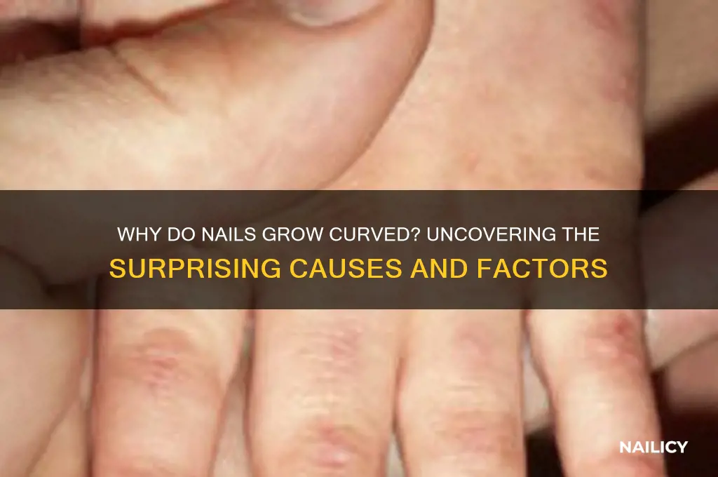 what makes nails grow curved