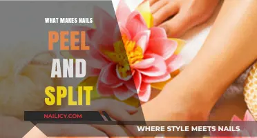 Why Nails Peel and Split: Causes and Prevention Tips