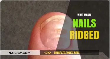 Understanding Ridged Nails: Causes, Prevention, and Treatment Options