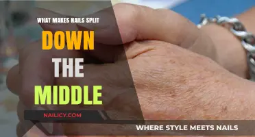 Why Nails Split Down the Middle: Causes and Solutions