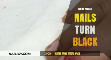 Black Nails: What's the Cause?