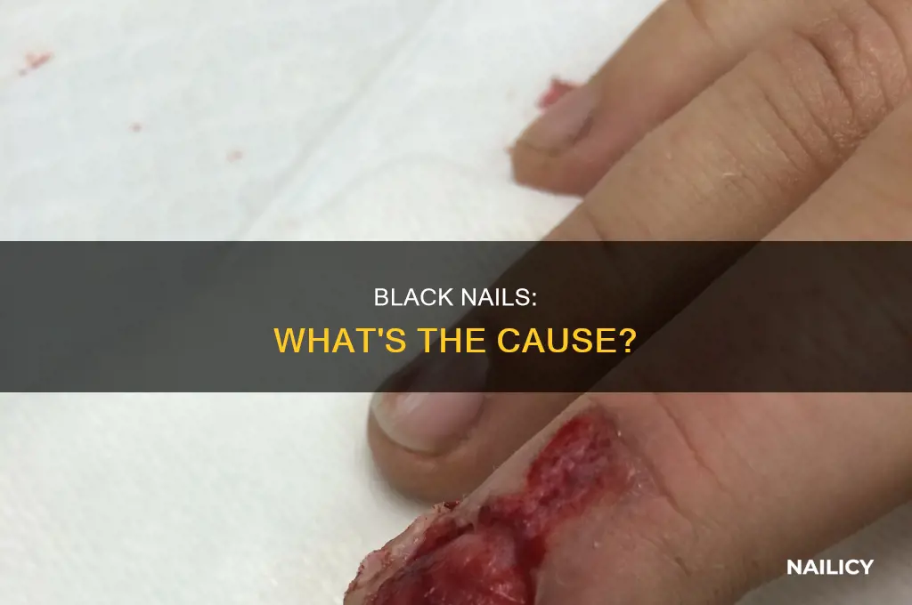 what makes nails turn black