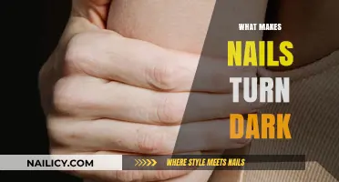Why Nails Darken: Causes, Concerns, and Prevention Tips Explained