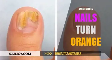 Why Nails Turn Orange: Causes, Prevention, and Treatment Explained