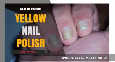 Why Yellow Nail Polish Turns Nails Yellow: Causes and Solutions