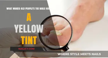 Why Do Elderly Toenails Turn Yellow? Causes and Care Explained