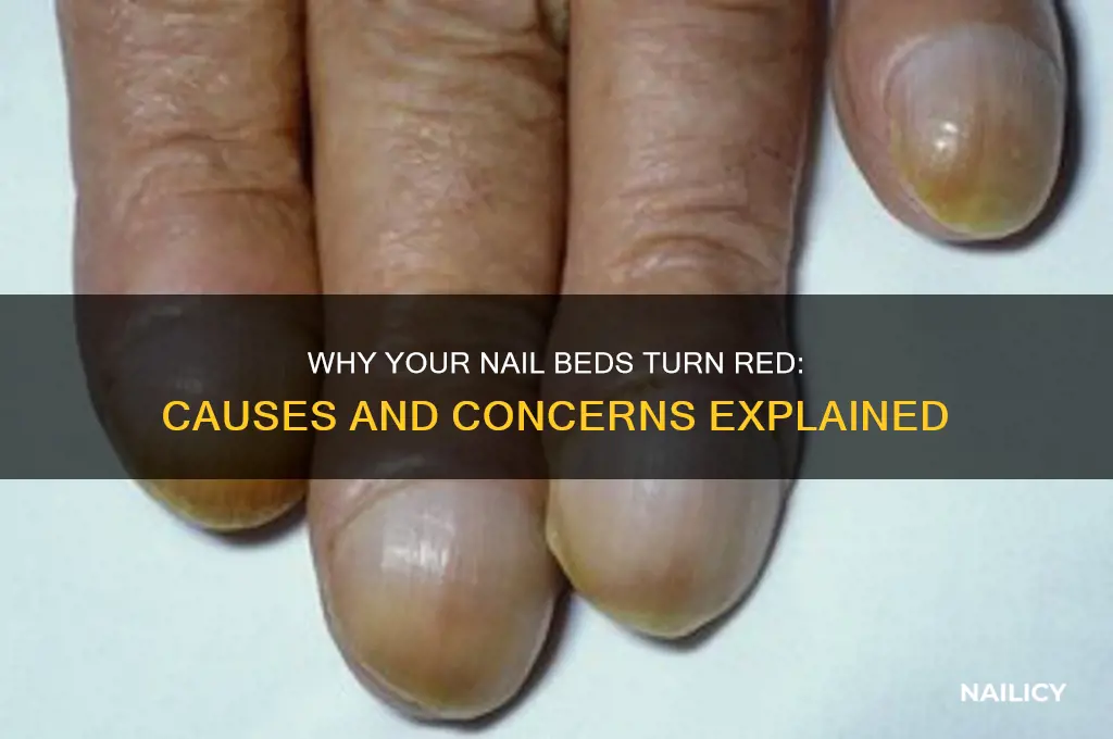 what makes the bed of your nails red