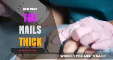 Why Toe Nails Thicken: Causes, Prevention, and Treatment Options