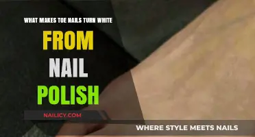 Why Nail Polish Turns Toenails White: Causes and Prevention Tips