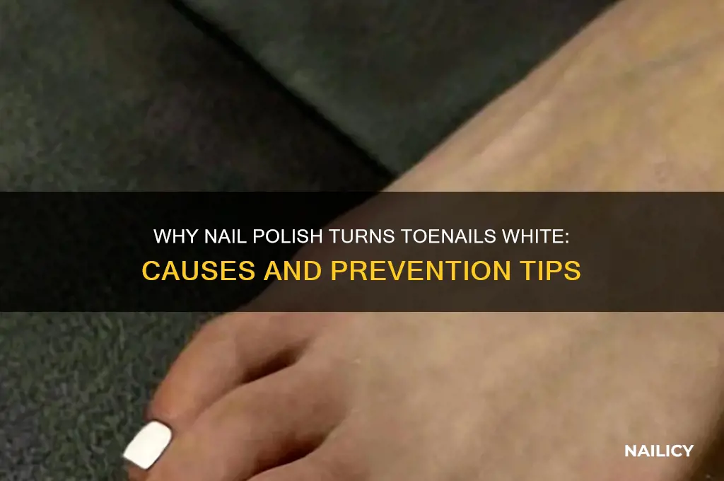what makes toe nails turn white from nail polish