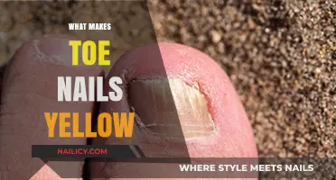 Why Toe Nails Turn Yellow: Causes and Solutions Explained