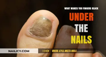 Why Do Fingernails Turn Black? Causes and Solutions Explained