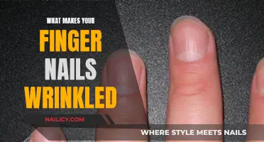 Unraveling the Mystery: Why Your Nails Wrinkle