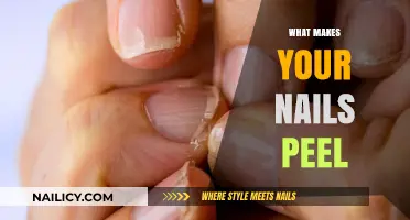 Nail Peeling: What's the Real Cause?