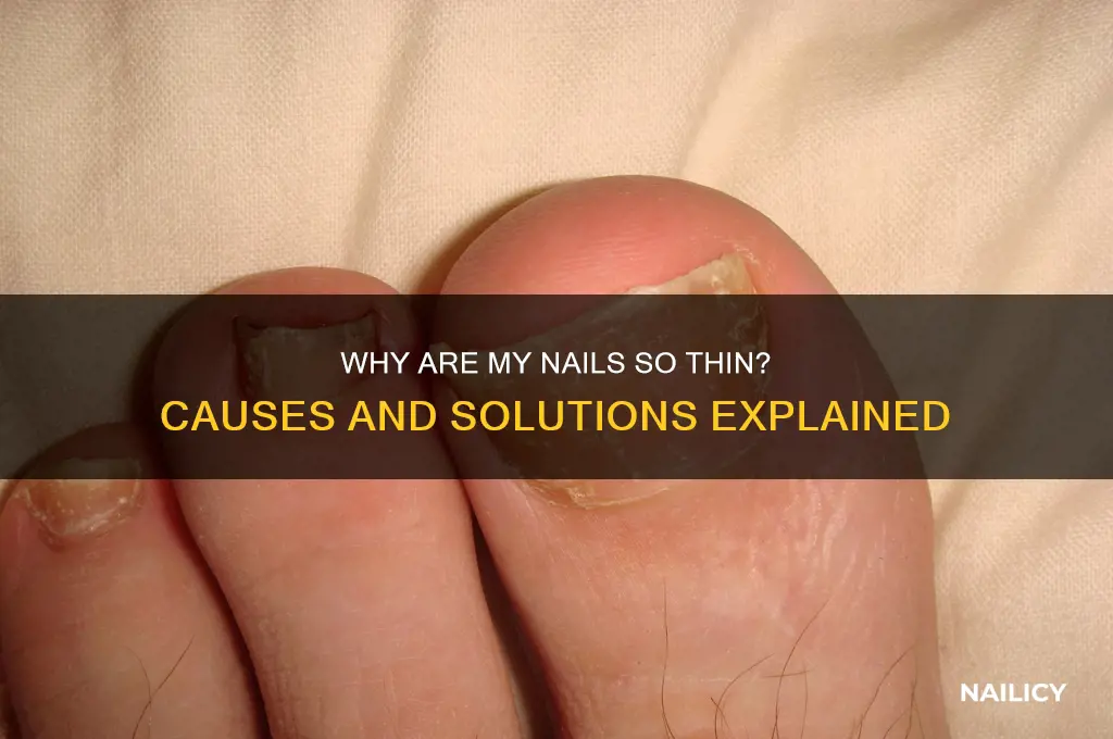 what makes your nails thin