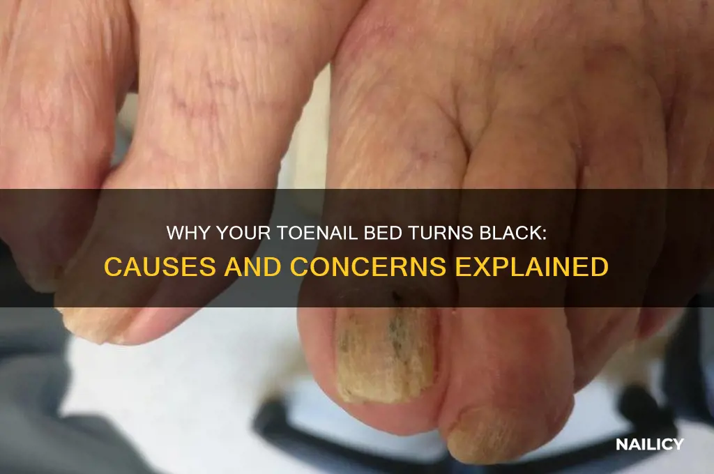 what makes your toe nail bed look black