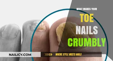 Why Toe Nails Become Crumbly: Causes, Prevention, and Treatment Tips