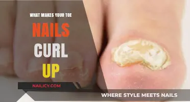 Why Toe Nails Curl Up: Causes, Prevention, and Treatment Options