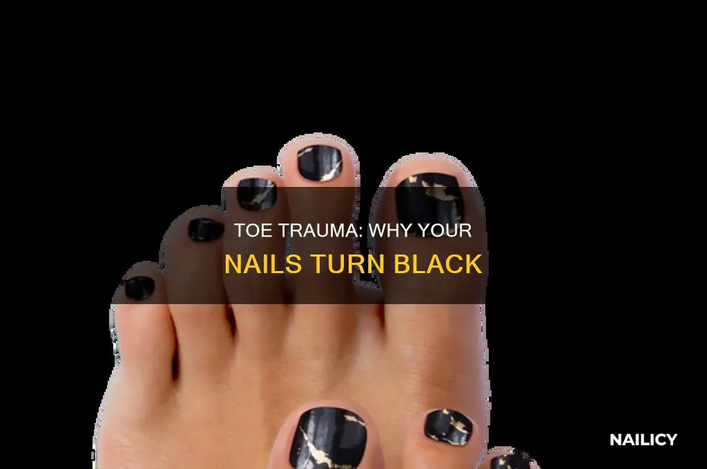 what makes your toe nails turn black