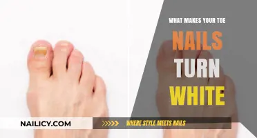 Why Toe Nails Turn White: Causes, Concerns, and Solutions Explained