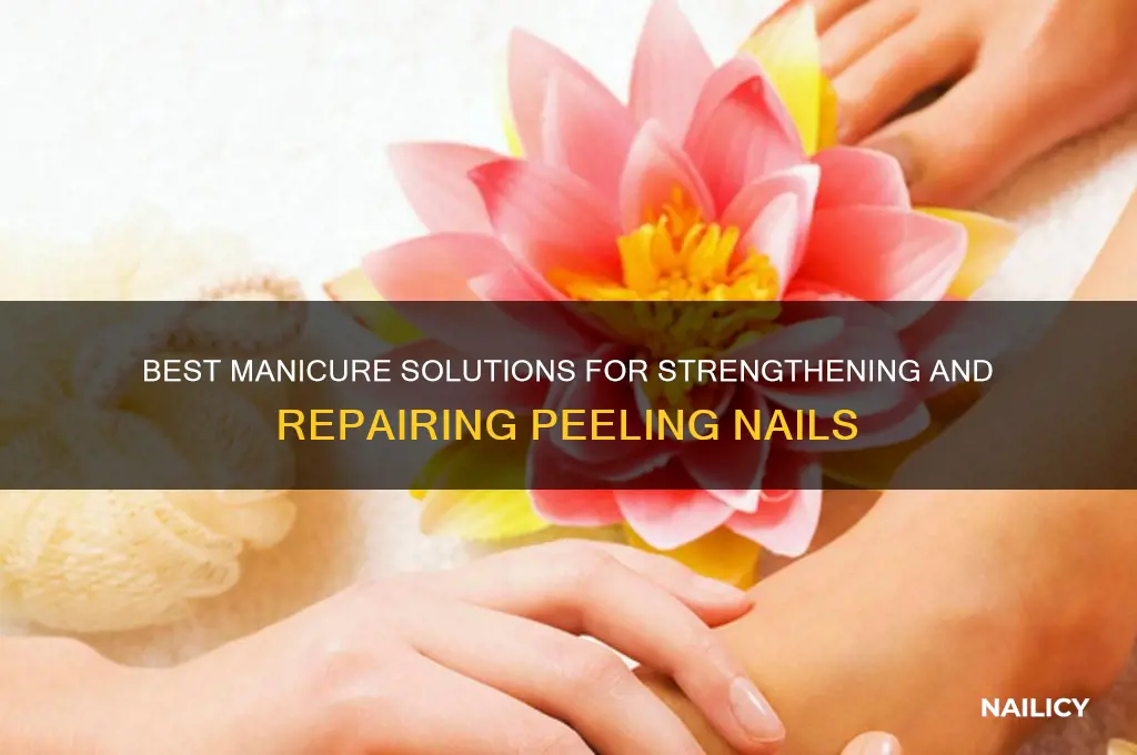 what manicure for peeling nails