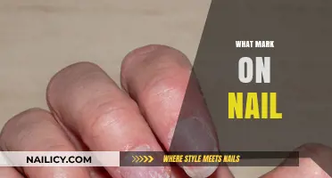 Understanding Nail Marks: Causes, Meanings, and When to Worry