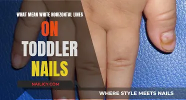Toddler Nail White Lines: What Do They Mean?