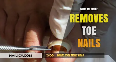 Effective Medication for Removing Toenails: What Are Your Options?