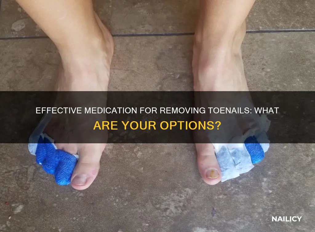 what medicine removes toe nails