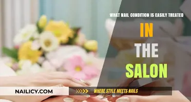 Simple Salon Solutions for Common Nail Conditions: Quick Fixes Revealed