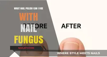 Nail Fungus and Polish: Safe Options for Healthy, Stylish Nails