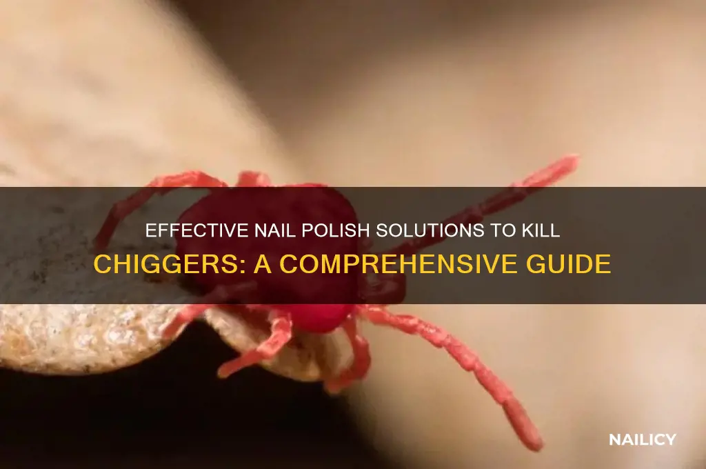 what nail polish kills chiggers