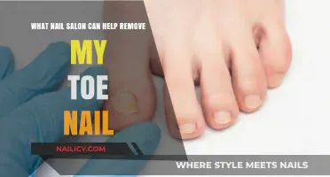Nail Salon Services: Toenail Removal and Care