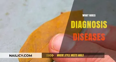 Nail Health Clues: Uncovering Diseases Through Nail Diagnosis Insights