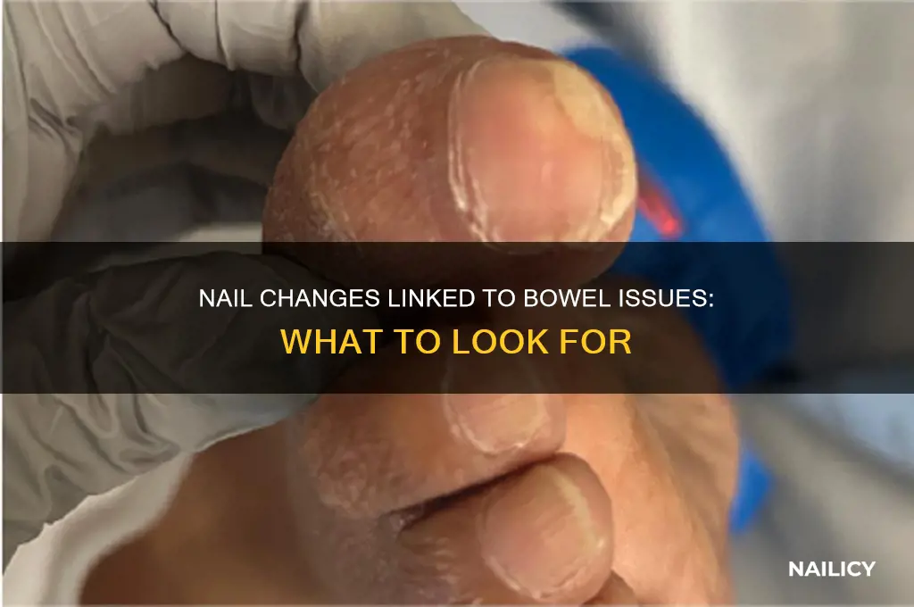 what nails look like with bowel problems