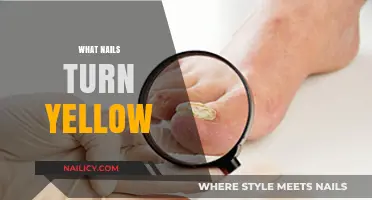 Why Nails Turn Yellow: Causes, Prevention, and Treatment Options