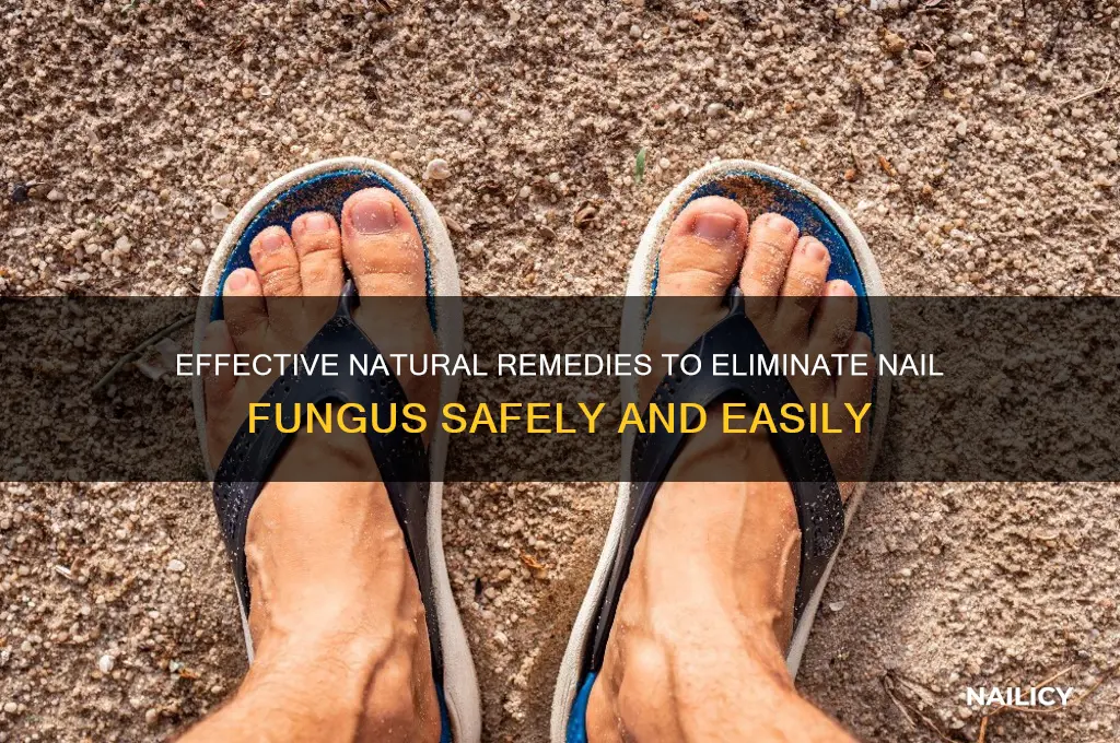 what naturally kills nail fingus