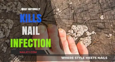 Effective Natural Remedies to Eliminate Nail Infections Safely and Quickly