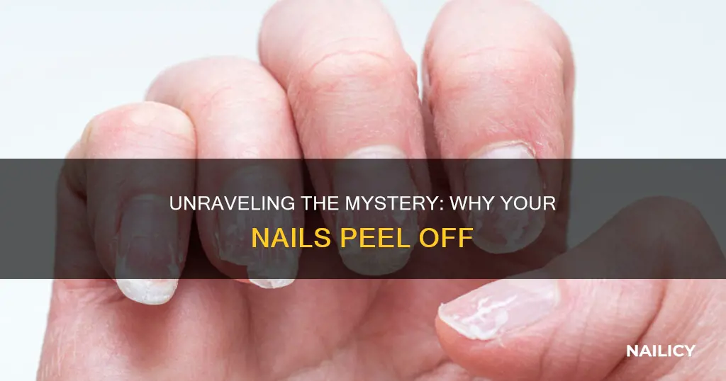 what neutrient causes finger nails to peal