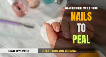 The Mystery of Peeling Nails: Nutrient Deficiency