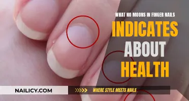 Unveiling the Mystery: No Moons on Nails, Health Alert!